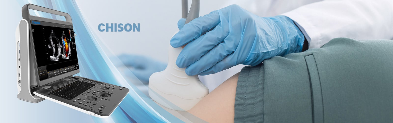 141581-ebit60-ultraschallsystem-chison_4er(1)