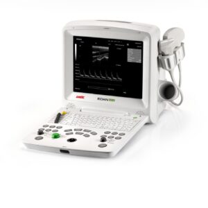 DUS 60 Ultrasound Machine