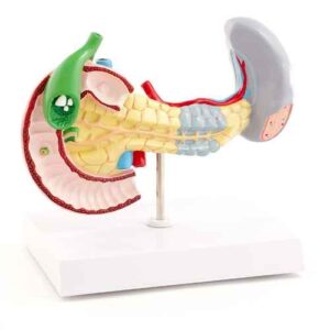 Pancreas, Spleen & Gallbladder Model with Diseases