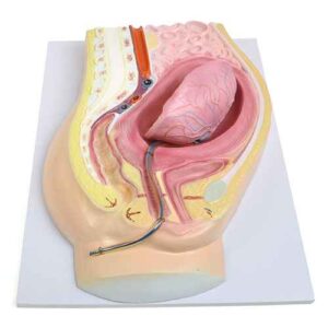 Placental Abruption Model