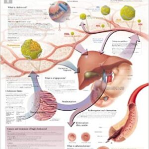Wall Chart “Cholesterol”