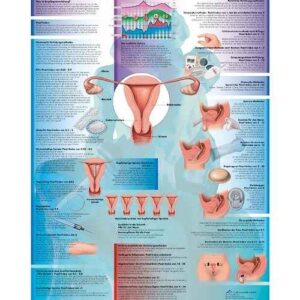 Wall Chart “Contraception”