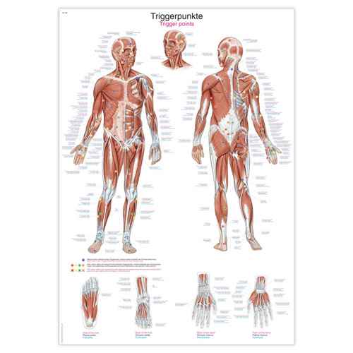 Wall Chart “Physiotherapy: Triggerpoints”