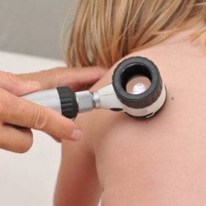 Dermatoscopes