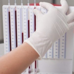 Blood Sedimentation Racks