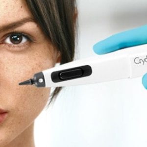 Cryotherapy/Cryosurgery