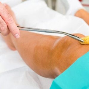 Forceps