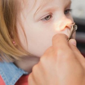 Nasal Speculum