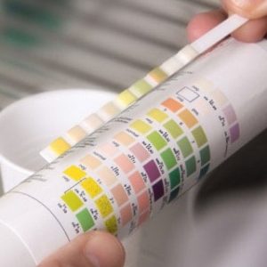 Urine Test Strips