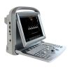 CHISON ECO5 Ultrasound Machine with Color Doppler