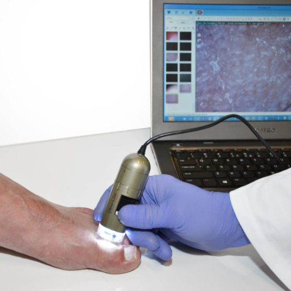 Dino-Lite PodoScope - Image 3
