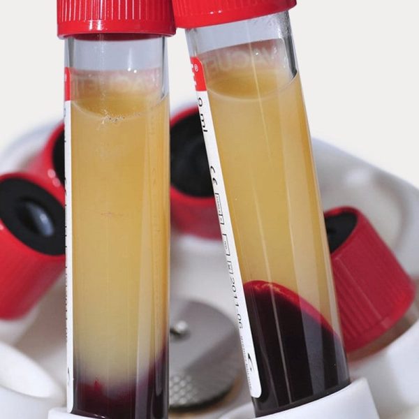 MEDIFUGE CGF Centrifuge - Image 2