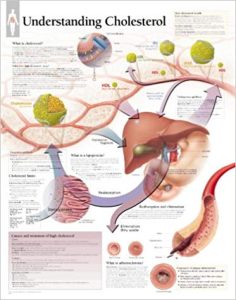 Wall Chart “Cholesterol”